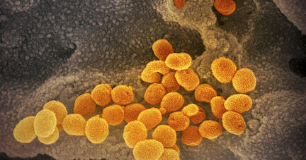 Eine elektronenmikroskopische Aufnahme des &laquo;U.S. National Institute of Health&raquo; zeigt das Coronavirus. Das Virus passt sich durch Mutationen st&auml;ndig seinem neuen Wirt, dem&nbsp;Menschan an. So sieht ein Coronavirus in einer Zelle aus, wenn man es mit einem Mikroskop sehr stark vergr&ouml;&szlig;ert. Foto: dpa