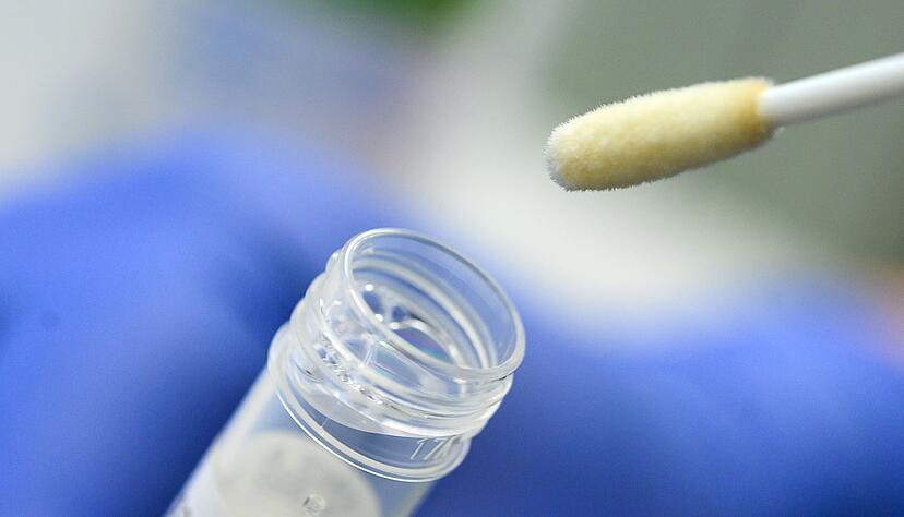 Ein Abstrich für das Testverfahren auf das Coronavirus.