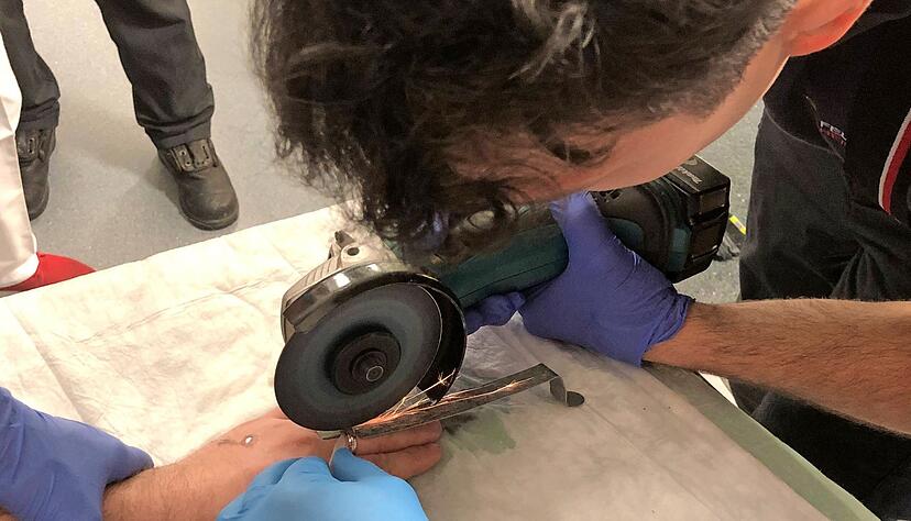 Wenn der Ring festsitzt und der Finger schon bedrohlich anschwillt, sind die Feinmotoriker der Heilbronner Feuerwehr gefragt.
