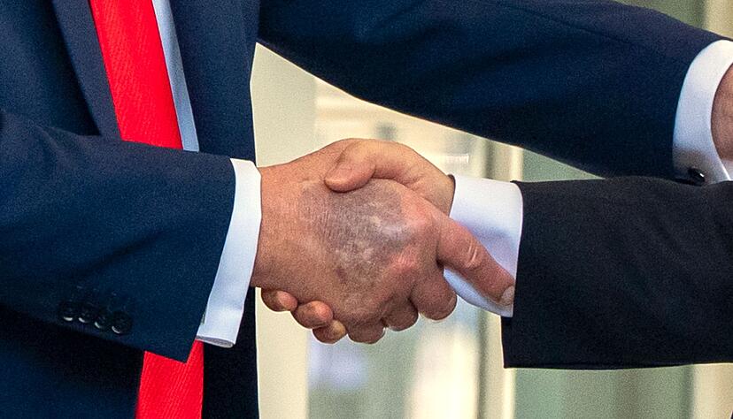 Zu sehen beim Händedruck mit dem südkoreanischen Präsidenten Lee: ein Bluterguss auf Trumps rechter Hand. Zu sehen beim Händedruck mit dem südkoreanischen Präsidenten Lee: ein Bluterguss auf Trumps rechter Hand.