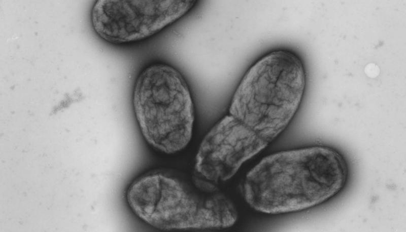 Eine elektronenmikroskopische Aufnahme zeigt das Pestbakterium Yersinia pestis. In China wurde der vierte Fall einer Pestinfektion innerhalb weniger Wochen gemeldet.