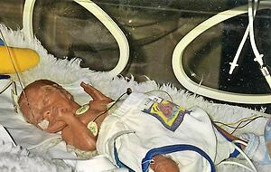 Die Frühchen-Hose war ihm viel zu groß. Für seine Eltern sei er "immer das schönste Baby gewesen", sagt seine Mutter.
Foto: privat Die Frühchen-Hose war ihm viel zu groß. Für seine Eltern sei er "immer das schönste Baby gewesen", sagt seine Mutter.
Foto: privat