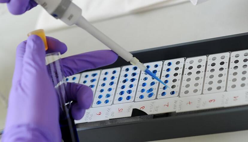 Das Robert-Koch-Institut hat eine Vielzahl von Hantavirus-Erkrankten ausgemacht. Foto: dpa Das Robert-Koch-Institut hat eine Vielzahl von Hantavirus-Erkrankten ausgemacht. Foto: dpa