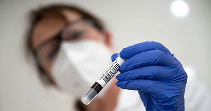 Eine Labormitarbeiterin hält ein Blutentahmeröhrchen mit Blut für einen Corona-Antikörper-Test in der Hand. Foto: dpa