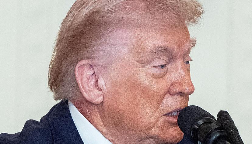 Eine Stelle an Trumps Hals hat eine Welle von Spekulationen &uuml;ber die Gesundheit des Pr&auml;sidenten ausgel&ouml;st.