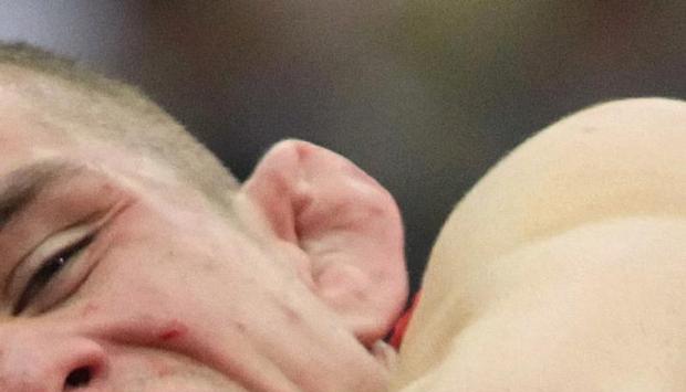 Ringer tragen oft das im Volksmund sogenannte &laquo;Blumenkohlohr&raquo;.