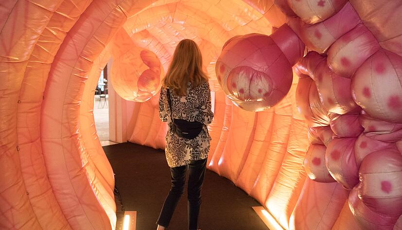 Viel los in der Schleimhaut des Darms: Aus Wucherungen, sogenannten Polypen, kann mit den Jahren Darmkrebs entstehen.