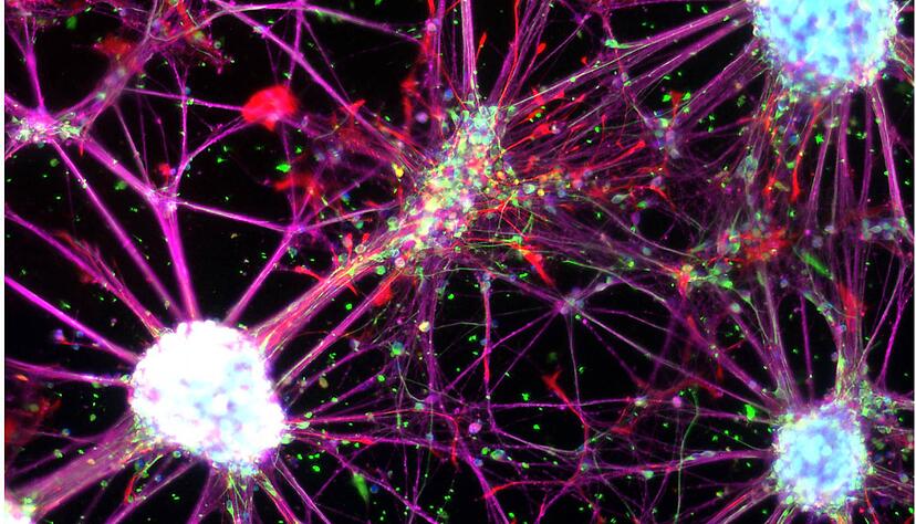 Das Mikroskop-Bild zeigt ein NervenzellenNetzwerk. Es wird von Stammzellen gebildet, die aus menschlichen Blutzellen umprogrammiert wurden. Diese Zellen sollen krankes Nervengewebe ersetzen.                                                     
Foto: DKFZ