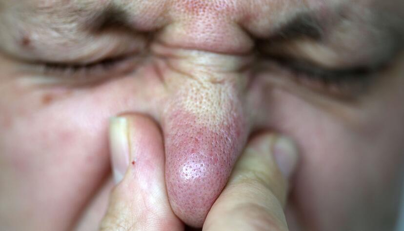 Ein Flug in der Economy-Klasse kann neben einem Viel-Pupser zur Herausforderung werden (Archivbild)