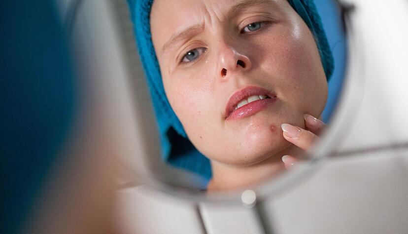 Mist, ein Pickel! Durch vermehrte Talgproduktion k&ouml;nnen Poren verstopfen und sich entz&uuml;nden. Das st&ouml;rt viele nicht nur optisch, sondern tut manchmal auch richtig weh.