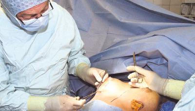 Der Markt für Brustoperationen boomt. In den meisten Fällen werden Silikonimplantate eingeschoben, manchmal wird aber auch Gewebe abgesaugt.Fotos: dpa