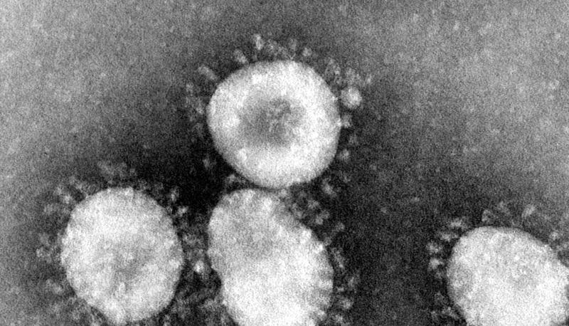 Ein Coronavirus unter dem Mikroskop.