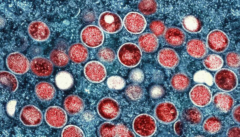 Diese Mikroskopaufnahme zeigt Mpox-Partikel in einer Zelle.