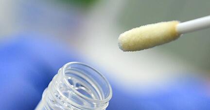 Ein Abstrich für das Testverfahren auf das Coronavirus.