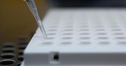 Die Delta-Variant des Coronavirus könnte auch in Deutschland bald vorherrschend sein.