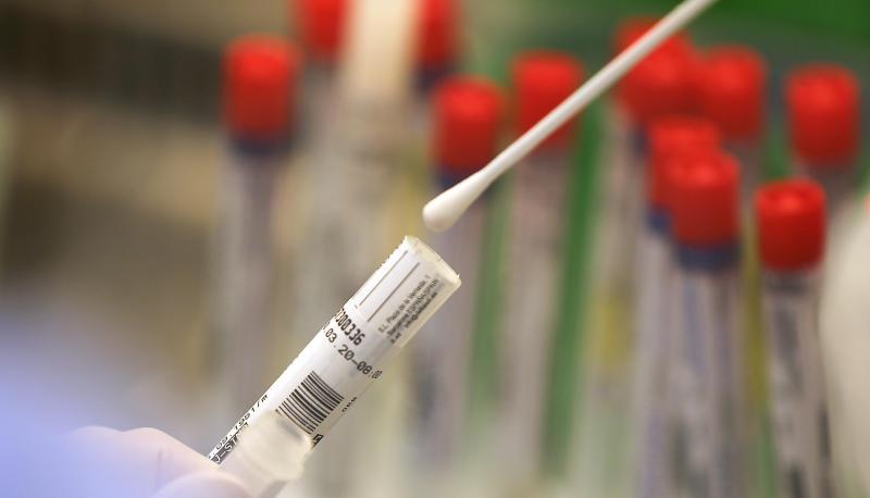 Ein Wattest&auml;bchen mit einem Abstrich wird im Labor f&uuml;r einen Corona-Test verarbeitet.