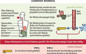 Verbreitung von Diabetes mellitus. Verbreitung von Diabetes mellitus.