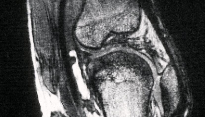Schmerzen im Knie treiben viele Versicherte zum Orthop&auml;den - viele kommen dort mit fragw&uuml;rdigen Therapien in Kontakt. (Archivbild)