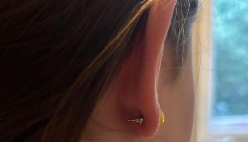 Verheilt alles gut? Eltern und Kind sollten das in den Wochen nach dem Ohrlochstechen immer wieder checken. Verheilt alles gut? Eltern und Kind sollten das in den Wochen nach dem Ohrlochstechen immer wieder checken.