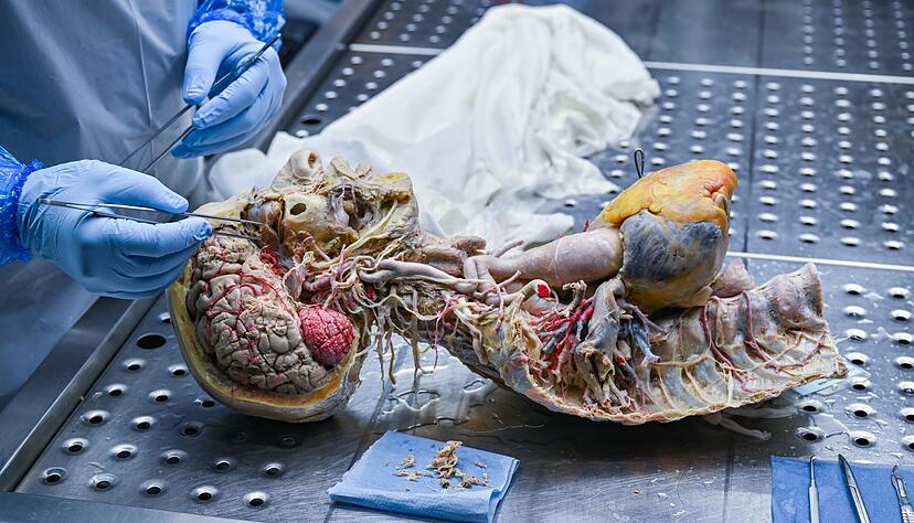 Die Ausstellungen sorgent immer wieder f&uuml;r Kritik, die sich insbesondere an der St&ouml;rung der Totenruhe festmachte (Archivbild).