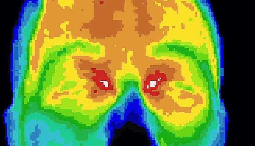 Mit einer hochaufl&ouml;senden Infrarotkamera werden die w&auml;rmsten Stellen am K&ouml;rper exakt ausgemessen.
Foto: IDS