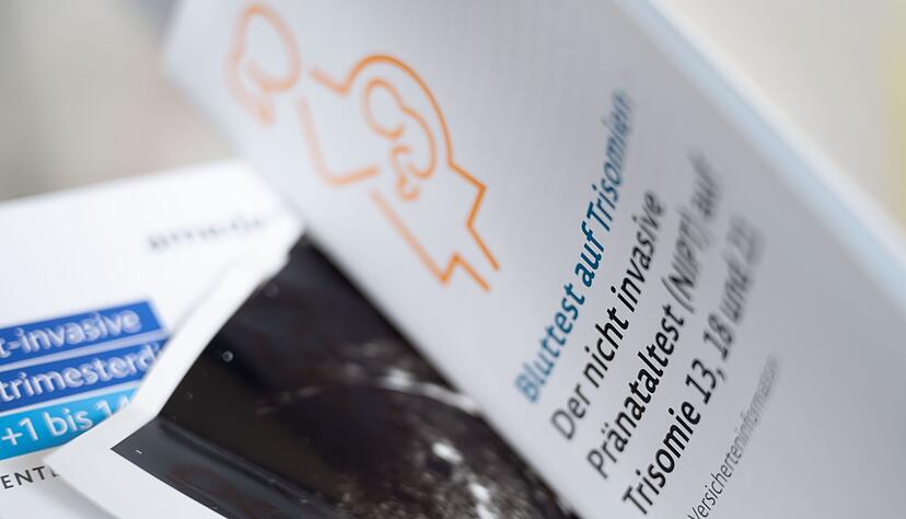Im Südwesten nutzen Schwangere vermehrt Bluttests zur Frühdiagnostik von Gendefekten wie etwa Trisomien. (Archivbild) Im Südwesten nutzen Schwangere vermehrt Bluttests zur Frühdiagnostik von Gendefekten wie etwa Trisomien. (Archivbild)